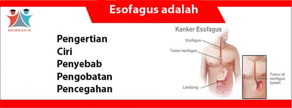 Esofagus